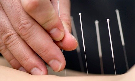 Up to 50% Off on Acupuncture Services at Antai Acupuncture