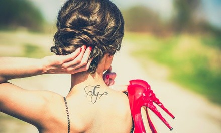 Up to 76% Off on Tattoo Removal at Mountain Island Skin Care