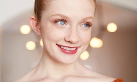 20 or 40 Units of Botox at Young Again Cosmetic Injections (Up to 11% Off)