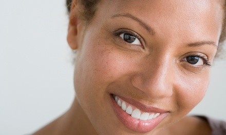 One Glycolic Acid, Salicylic Acid, or TCA Peel at TMN Skincare and Wellness (Up to 41% Off)