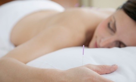 Up to 43% Off on Acupuncture Services at AIM Health