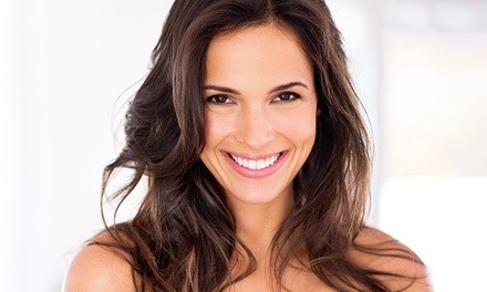 $55 for $3,500 Worth of Full Invisalign Treatment at Design Dental Spa