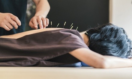 Initial Consultation and One Acupuncture Session at Anna Health (Up to 51% Off)