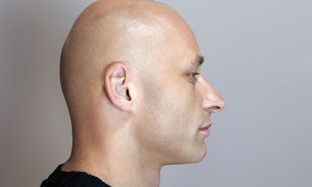 1 Scar Camouflage or 1, 2, 3, or 4 Scalp Micropigmentation Sessions at Micropigmentation Academy (Up to 52% Off)