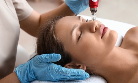 One or Three Dermapen Microneedling Facials at Laser Duet (Up to 81% Off). Four Options Available.