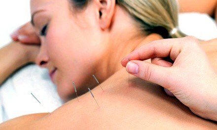 Three Acupuncture Treatments with Consultation from Kristina Katinka (69% Off)