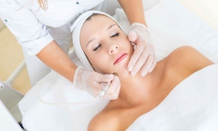 One or Three Microdermabrasions with Peels at Glamour Skin Care (Up to 71% Off)