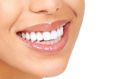 Dental Exam, X-Ray, Cleaning, Teeth Whitening, Retainer, More at United Dental Group (Up to 92% Off). 8 Options.