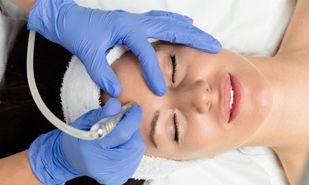 Hydrodermabrasion with Customized Facial and Optional Vitamin C Exfoliation at Allure Skin Care (Up to 48% Off)