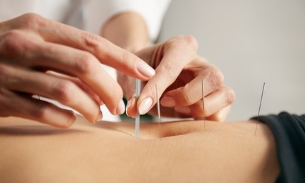 Up to 47% Off Acupuncture Sessions at HUNAN ACUPUNCTURE P.C.