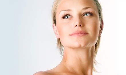 One or Two IPL Photofacials at Landa MedSpa (Up to 54% Off) 