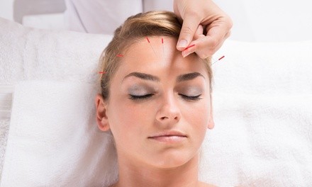 Up to 35% Off on Acupuncture Consultation and 1 or 2 treatments at Community First Acupuncture