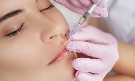 Juvederm Injections at Faces Med Spa (Up to 46% Off). Three Options Available.