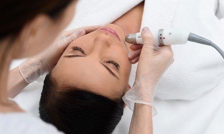 Up to 56% Off on Microdermabrasion at San Diego Brow and Beauty Company