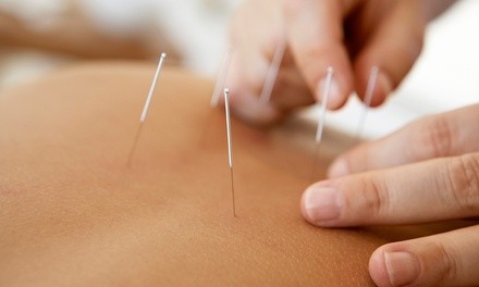 One Traditional Acupuncture Treatment or Two Facial Acupuncture Treatments at Troy Acupuncture Center (Up to 68% Off)