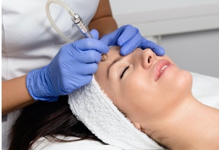 Up to 58% Off on Microdermabrasion at Divine Glow Aesthetics & Beauty Spa