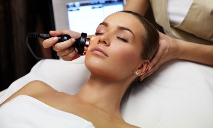 One, Two, or Four Therma-Lift Skin Tightening Facelifts at Prestige Face & Body Sculpting (Up to 88% Off)