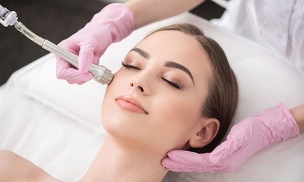 One Microdermabrasion or Dermaplanning Session at Angel's Touch Day Spa (Up to 63% Off)