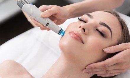 One or Three Micro-Needling Treatments at Broadway SkinCare (Up to 62% Off)