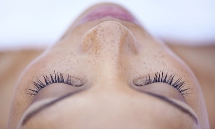 One or Three Revitalizing Chemical Peels with Dermaplane Treatments at Revive Medical Center (Up to 75% Off)