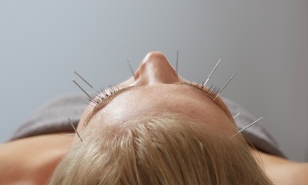 One or Two Acupuncture Sessions or Acupuncture and Chiropractic Session at Quest Chiropractic (Up to 62% Off)