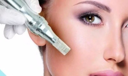 Microneedling Treatments at Rose and Thorn Day Spa (Up to  80% Off)