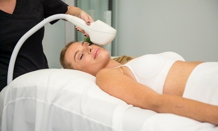 One or Two IPL Facials at St. Pete Wellness & Med Spa (Up to 58% Off)