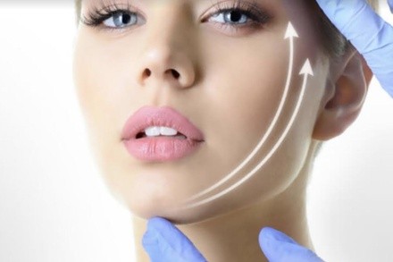 One focused ultrasound full face lift service or Non-Surgical Aesthetic Face Lift at Shape of You (Up to 67% Off)