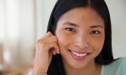 20 Units of Botox at Youthfill MD (Up to 36% Off) 