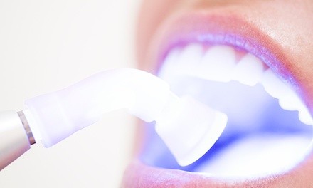 Up to 92% Off on Dental Checkup (Cleaning, X-Ray, Exam) at Dream Smiles Come True