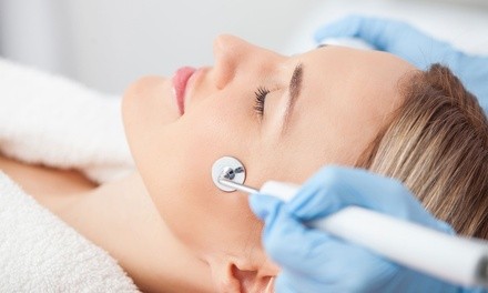 One or Three Microdermabrasions with Chemical Peels from Jeffrey at JD Salon & Spa (Up to 62% Off)