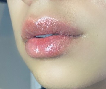 Up to 56% Off on Lip Enhancement at Marie London Beaute