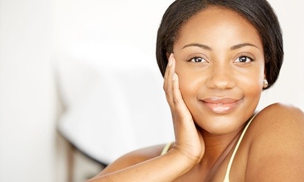 One or Two Chemical Peels at A New You Aesthetics (Up to 70% Off)