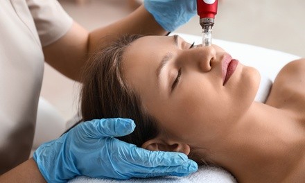 Up to 52% Off on Microneedling with PRP at Charlie Chen MD