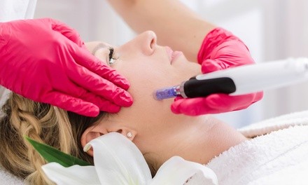 One or Two Microneedling Treatments with Anti-Aging Facial at Exquisite Skin Studio (Up to 74% Off)