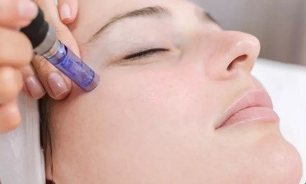 Up to 30% Off on Micro-Needling at Embodiment MedSpa