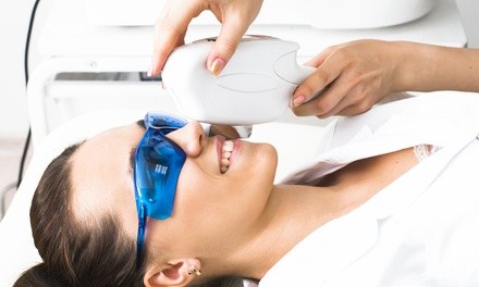 One or Four Laser Dark-Spot-Removal Sessions at Touch Laser Medical Spa (Up to 62% Off)