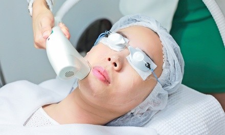 IPL Photofacial at Lilac Laser and Aesthetics (Up to 67% Off)