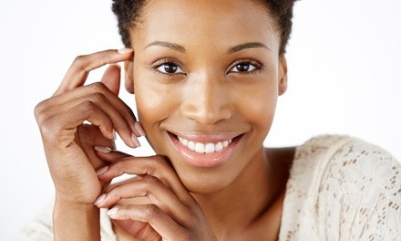 $50.15 for Microdermabrasion at Sanctuary DermaSpa ($125 Value)