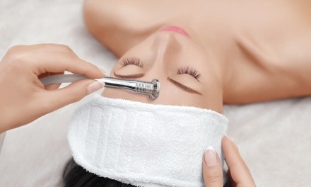 Facial Chemical Peel or Microdermabrasion Treatment at Royal Touch Experience (Up to 50% Off)