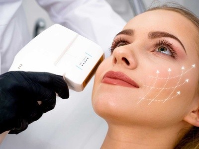HIFU Ultrasound Lift for Full Face and Optional Neck at Fascino Med Spa (Up to 36% Off)