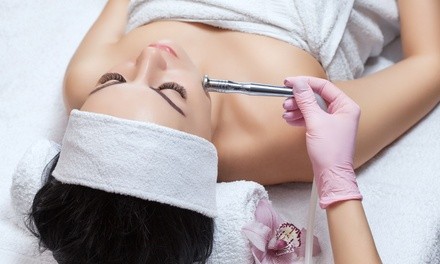 One or Three Diamond Microdermabrasion Treatments with Custom Facials at Dyscover Med Spa (Up to 56% Off)