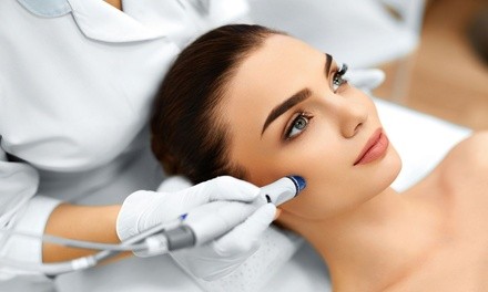 Microdermabrasion with an Anti-Sensitive Facial or 24K Gold Collagen Treatment at Swan Day Spa (Up to 52% Off)