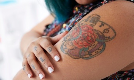 PicoSure Laser Tattoo-Removal Session at The Laser Spa At Sonoma (Up to 60% Off). Five Options Available. 