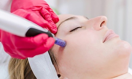 Microneedling Session with Optional Treatments from Henry Von Norden at The Aesthetic Couture (Up to 57% Off)