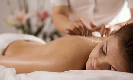 One or Two 60-Minute Acupuncture Sessions at Essence of China Acupuncture and Herb Clinic (Up to 46% Off)