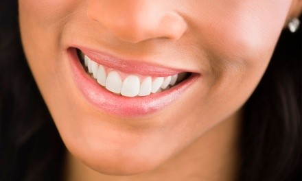 Up to 72% Off on Dental Checkup (Cleaning, X-Ray, Exam) at The Smilist