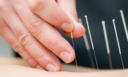 Up to 75% Off on Acupuncture Services at G S Chun Acupuncture