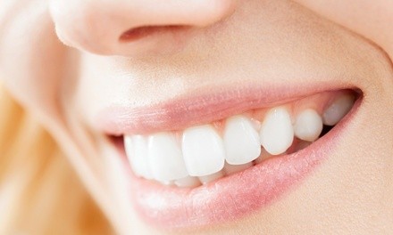 Dental Exam and X-Rays at Gemini Dental (Up to 89% Off). Two Options Available.