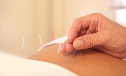 One Acupuncture Treatment at Cindy's Healing Arts Clinic (Up to 56% Off)